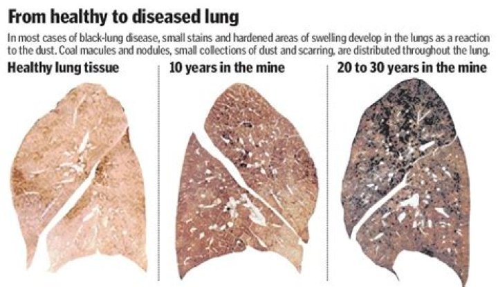 Black Lung Coal