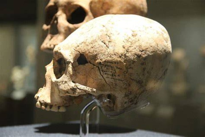Elongated Skull