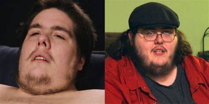 How much weight has Justin Assanti lost?
