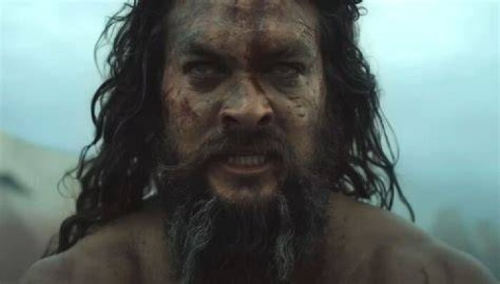 Is Jason Momoa actually blind in one eye?