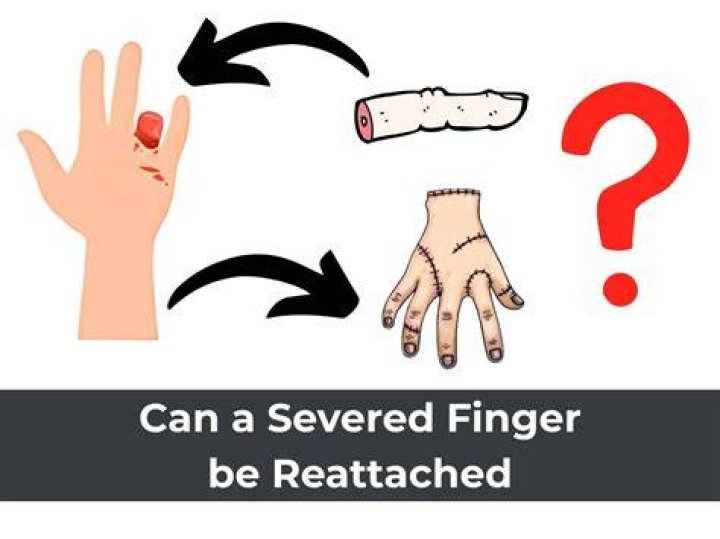 One Severed Hand
