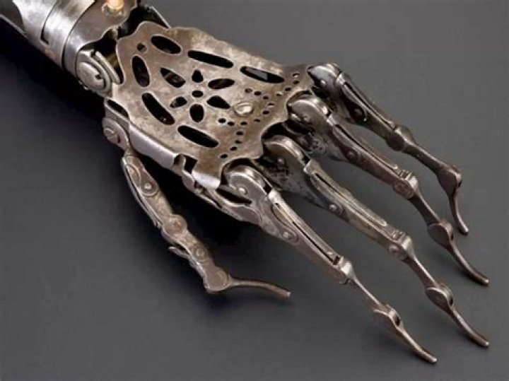 Skeleton With Prosthetic Hand