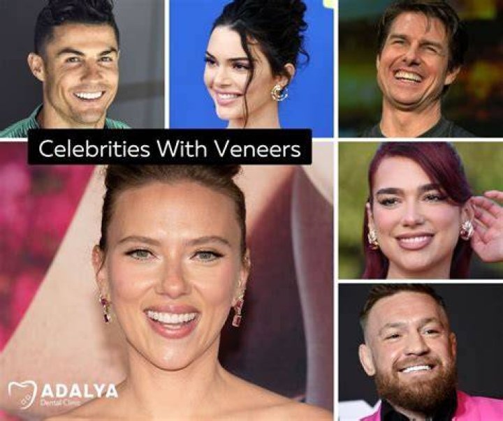 Why do celebrities not wear glasses?